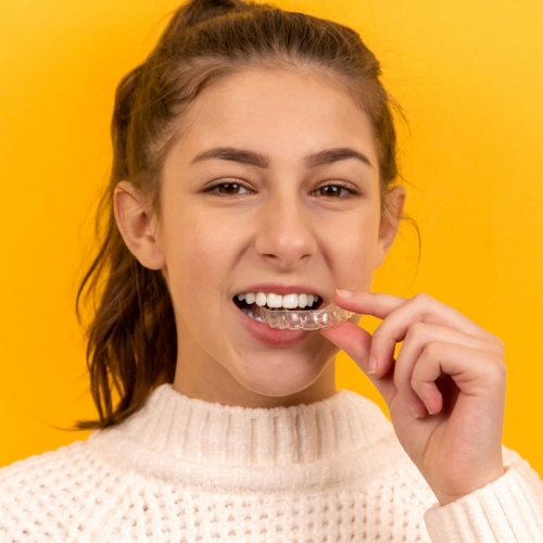 Clear Aligners