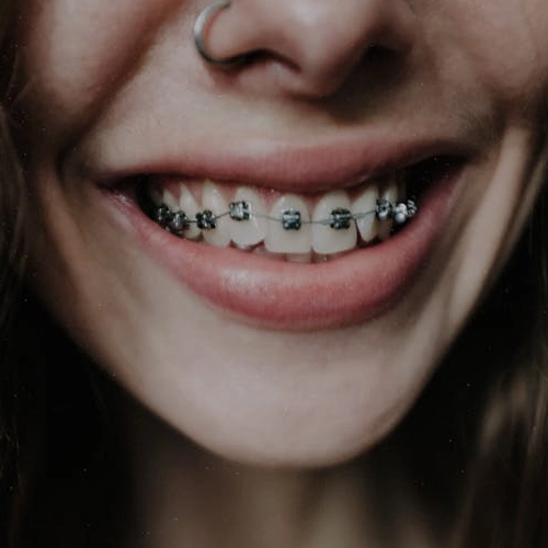 Dental treatment